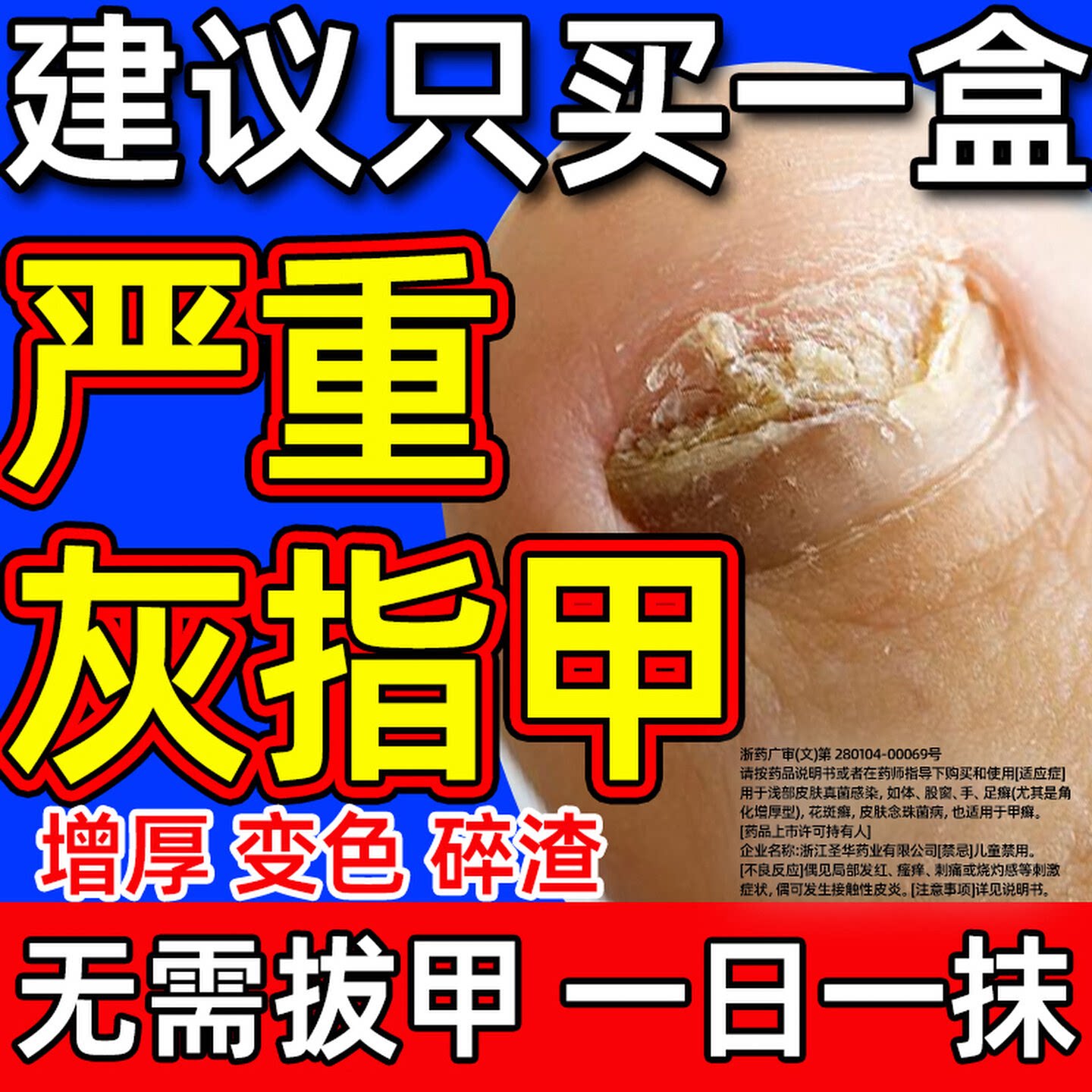 [金归]环吡酮胺乳膏1%*20g*1支/盒