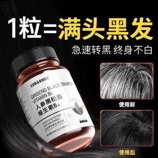 【官方正品】生物素维生素h黑发片叶酸酪氨酸维生素b6b76白头发zz