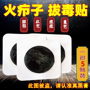 火疖子拔毒贴去吸脓包屁股脓包红肿硬疙瘩拔脓贴专用传统黑膏药贴