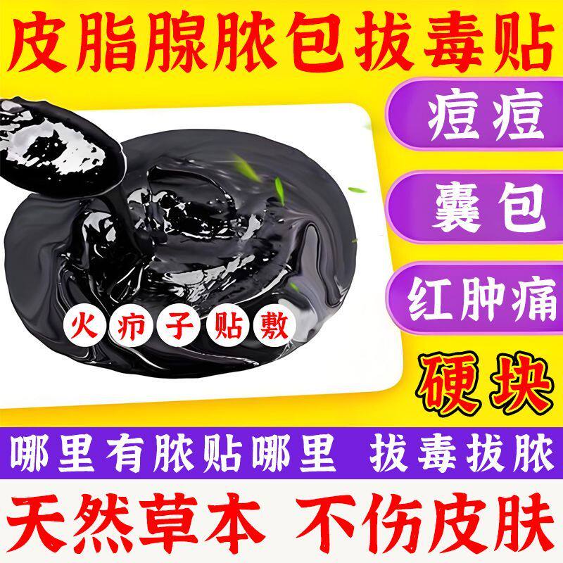 坐板疮火疖子拔脓拔毒膏屁股脓包拔毒贴坐板疮黑膏贴吸脓包专用贴