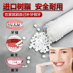 补牙神器自己在家补牙缝临时假牙填充树脂材料单颗门牙套牙仿缺牙