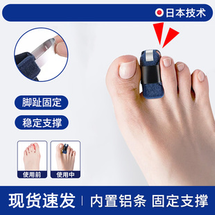 大小脚趾骨折固定器拇指外翻矫正趾头脱受伤臼支具夹板脚套固定夹