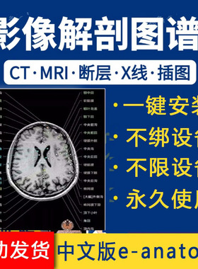 影像解剖图谱app 中文e-anatomy人体断层影像解剖ct mri 放射软件