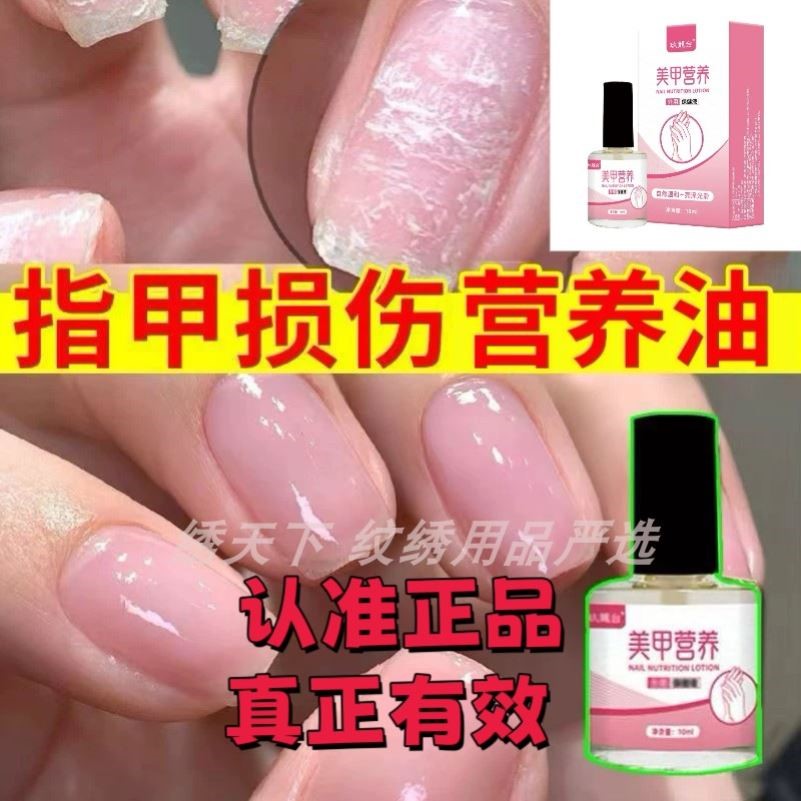 指缘油指甲营养油美甲护甲油手指缝修护液防倒刺护理液