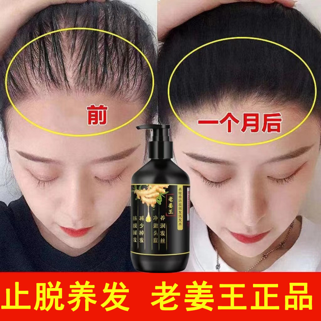 高缇雅老姜王防脱发洗发水生姜精华生发增发密发固止痒控油洗发露