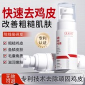 鸡皮肤去除神器干燥起皮瘩毛囊疙角质化角鱼鳞蛇霜皮肤护理乳霜