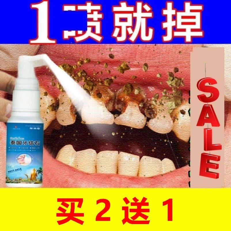 洗牙结石药水去除牙垢牙黄溶解牙石专用去除神器护理漱口水