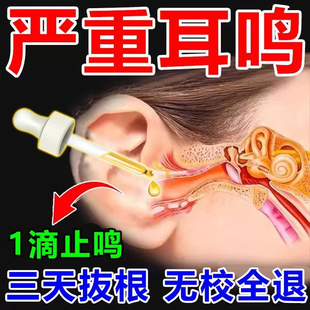 耳结石软化油邦耳适咽鼓管吹张器中耳负压恒压积液鼓膜内陷耳闷堵