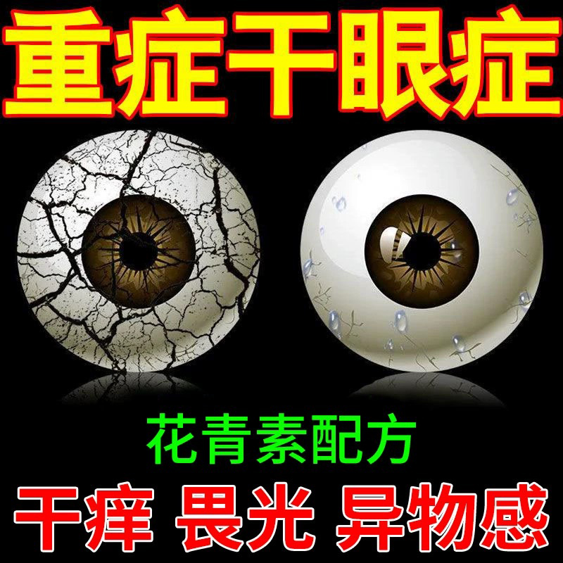 珍视明滴眼液玻璃酸钠滴眼液10ml干眼症状德国进口眼药水润眼液人