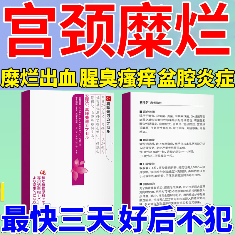 乳酸菌素阴道舒奈美女性阴道益生菌乳酸杆菌片妇科私密活菌栓剂