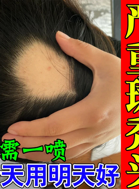 补肾乌发丸天麻首乌片养血头痛脱发白发耳鸣非黑发同仁堂人参