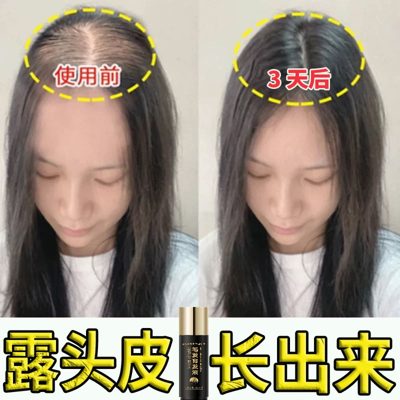 何首乌生发片苗岭原始森林生长特级野生制首乌片黑发防脱发男女