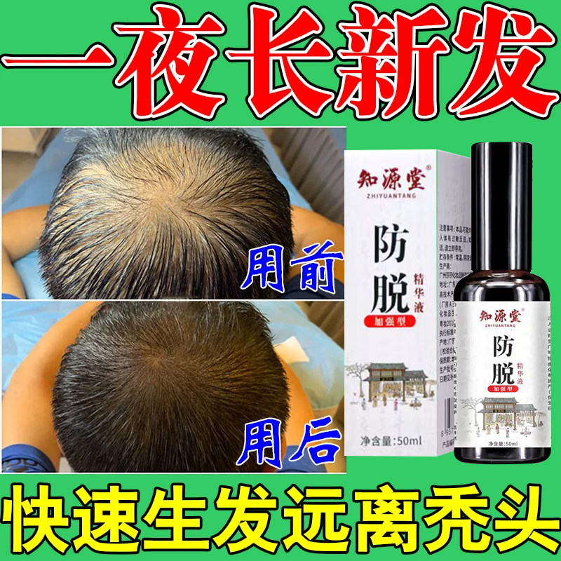 何首乌生发片百年锦纶纹五轮野生制何首乌特级正品白发乌发