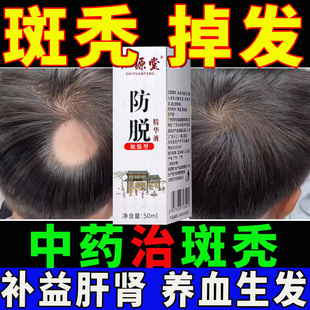 斑秃米诺地尔町生发液2%女性斯必申脱发育发生发液搽剂非凝胶