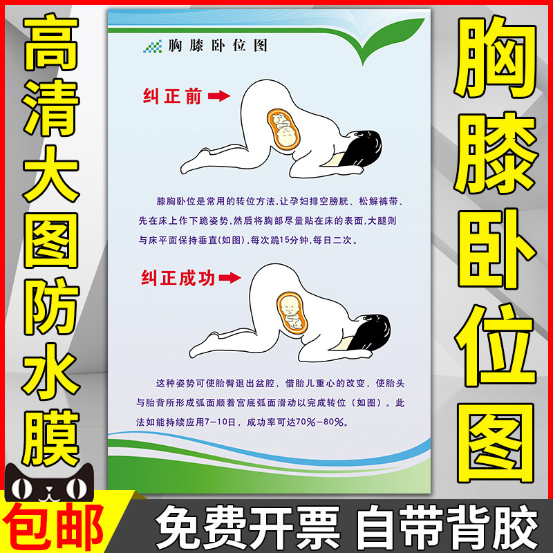 医院文化知识宣传海报胸膝卧位图妇幼保院产房病房装饰墙贴纸挂图