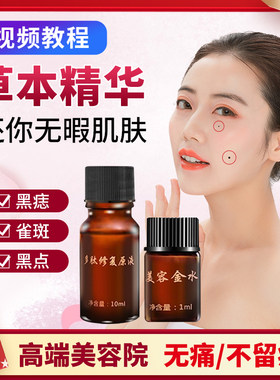 脸部祛斑药水遗传痦子黑点神器