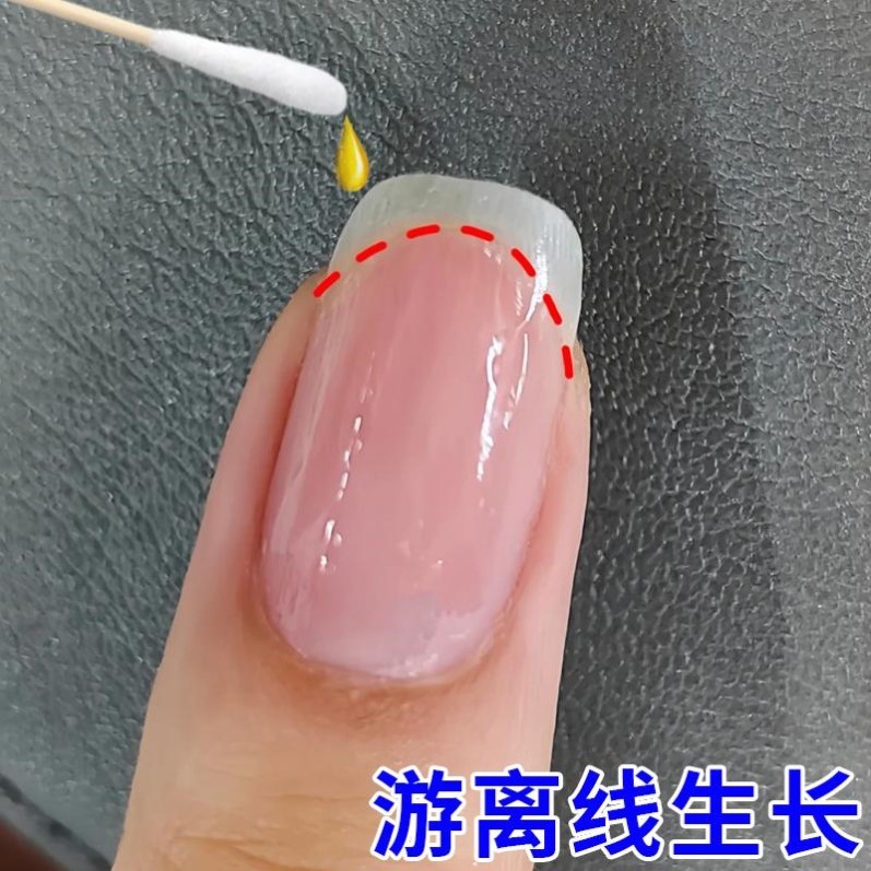 指甲游离线生长液护甲油萎缩增长液延长养甲床分离营养油空甲修复