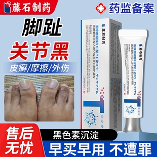 脚趾关节发黑关节癣出现黑色干肉去死皮黑色素沉淀湿疹干燥厚茧EM