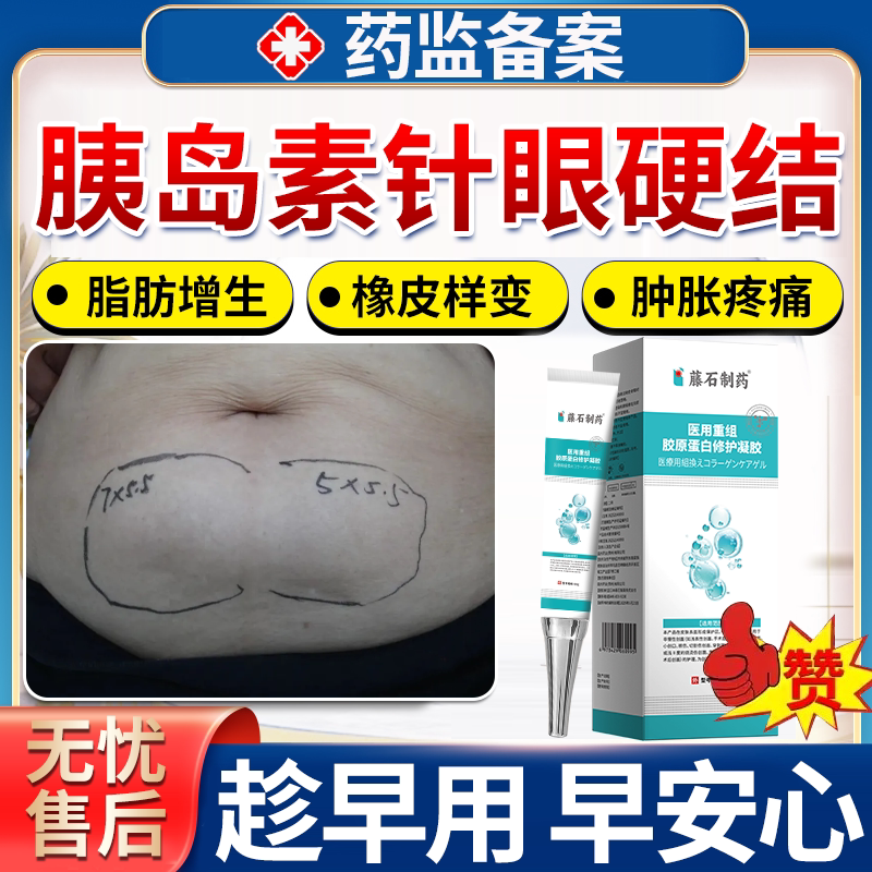 血糖高人打针硬块消肿胰岛素针眼消硬结鼓硬包皮肤修护理复软膏OZ