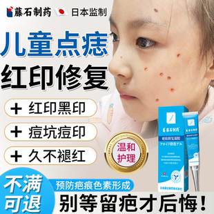 儿童激光点痣后疤痕红印修复去黑印色素沉淀凹坑医用硅酮祛疤膏BS