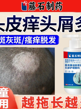 儿童头部头癣头皮屑银屑癣脂溢性皮炎专用真菌感染薬房同款膏JW