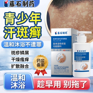 汗斑专用沐浴露花斑藓感染药房同款冲凉液泡澡儿童洗剂马拉色菌OZ