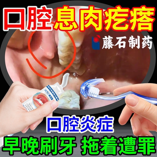 口腔息肉去除神器牙龈长肉瘤药口腔内壁起疙瘩唾液腺囊肿切除器OZ