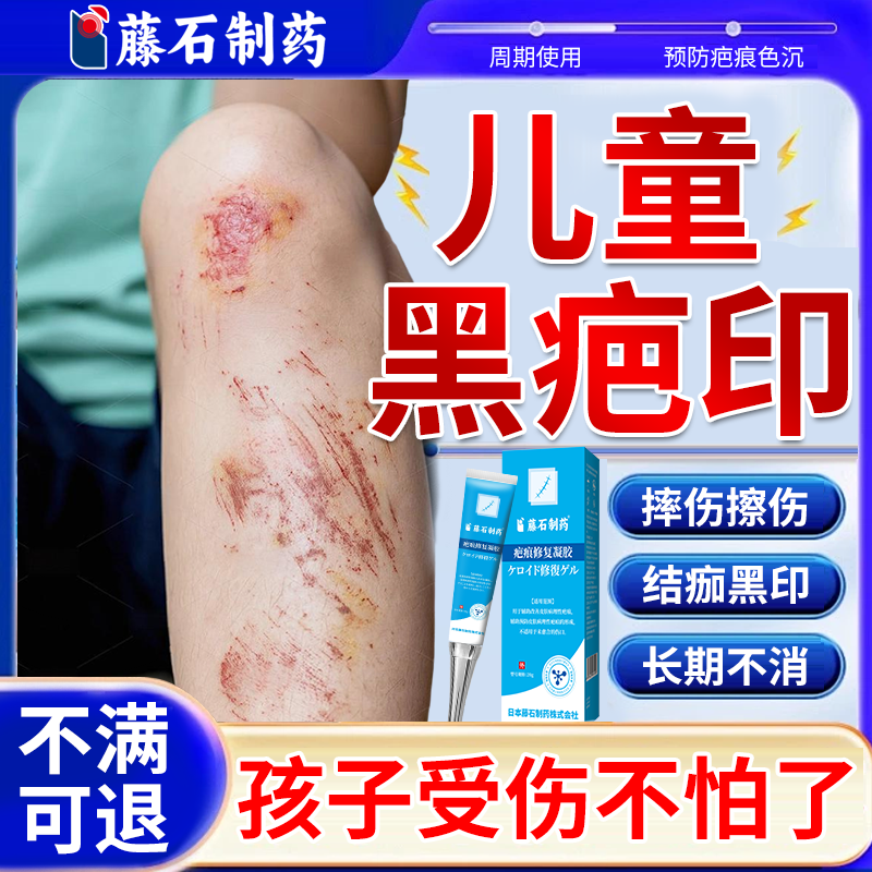 儿童擦伤破皮黑疤印医用祛疤膏