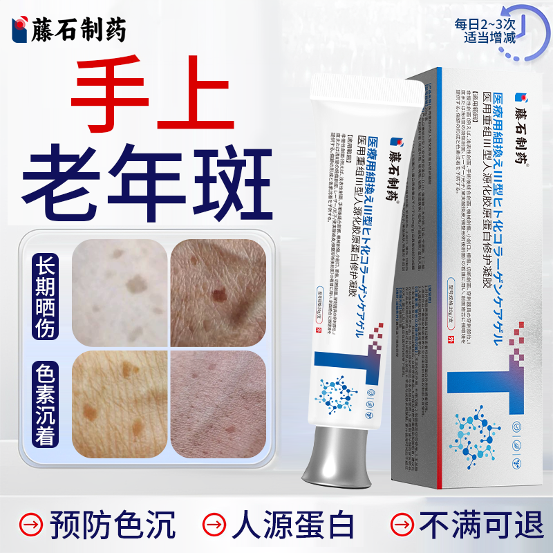 手上手背老年斑强力去除手部脸部扁平疣专用的药房膏一抹净斑点OZ