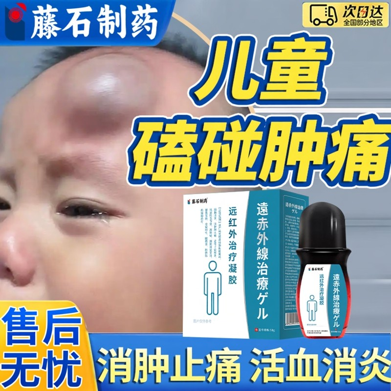 儿童宝宝淤青膏磕碰摔伤跌打损伤活血化瘀舒筋快速消肿止痛外用BS