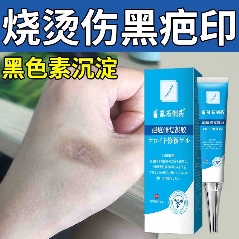 油烫伤烧伤疤痕去黑印色素沉淀淡化除疤膏去疤祛疤修复凝胶去除JW