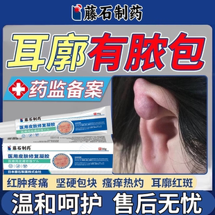 外耳廓假性囊肿夹子耳朵疖肿胀有硬块肿瘤皮脂腺消软骨膜炎增生EM