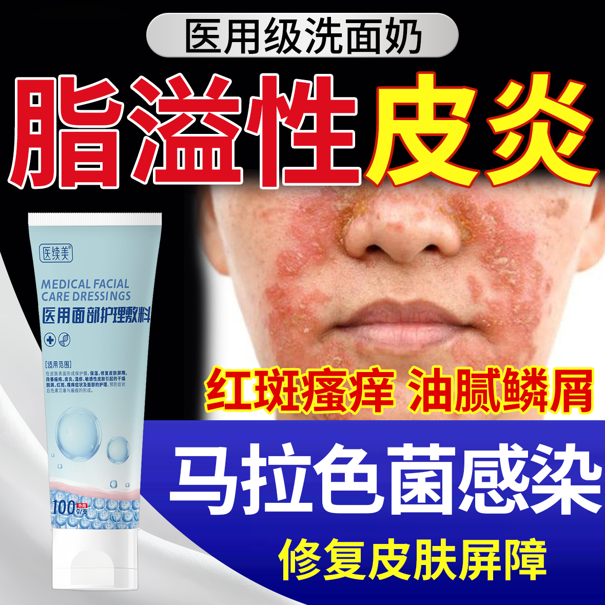 修复屏障】脂溢性皮炎专用洗面奶