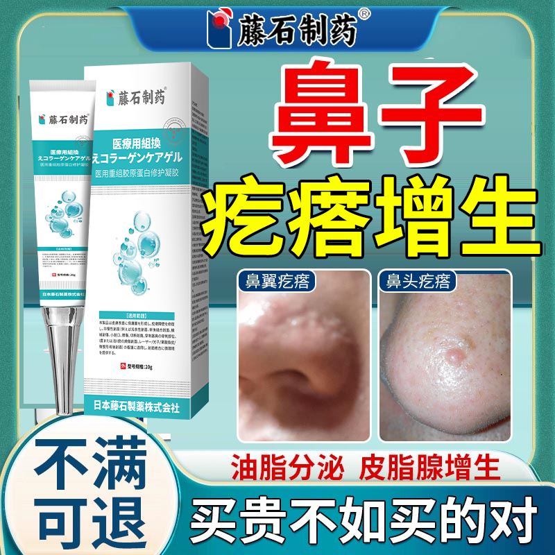 鼻子上小肉疙瘩鼻翼鼻头增生皮脂腺增生痘疤凸起酒糟鼻脸上肉粒OZ,保健用品,皮肤消毒护理（消）,淘宝优惠券,粉丝福利购,淘宝优惠卷