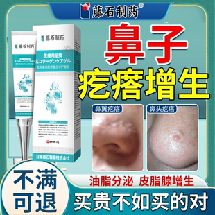 鼻子上小肉疙瘩鼻翼鼻头增生皮脂腺增生痘疤凸起酒糟鼻脸上肉粒OZ