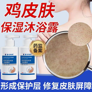 藤石制鸡皮肤疙瘩毛囊角化症专用沐浴露改善去除神器搭身体乳EM