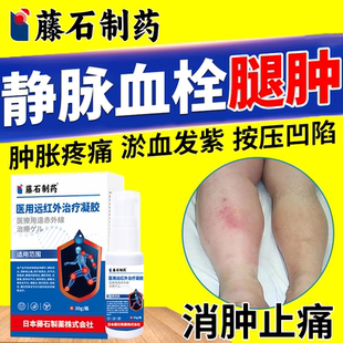 下肢深静脉血栓浮肿吃什么肿胀防小腿肿丘栓扩张后遗症的膏药贴OZ