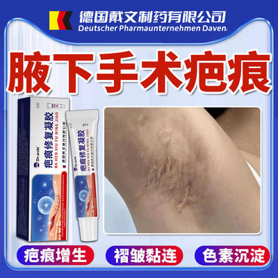 代文疤痕凝胶现货速发