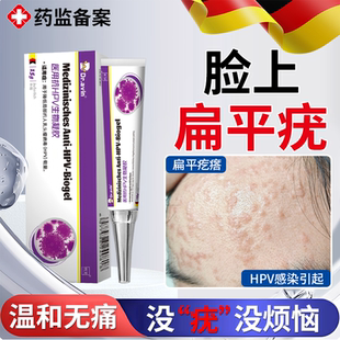 脸上扁平疣去除一抹灵面颈部专用软膏根医用级hpv去疣药房同款JW