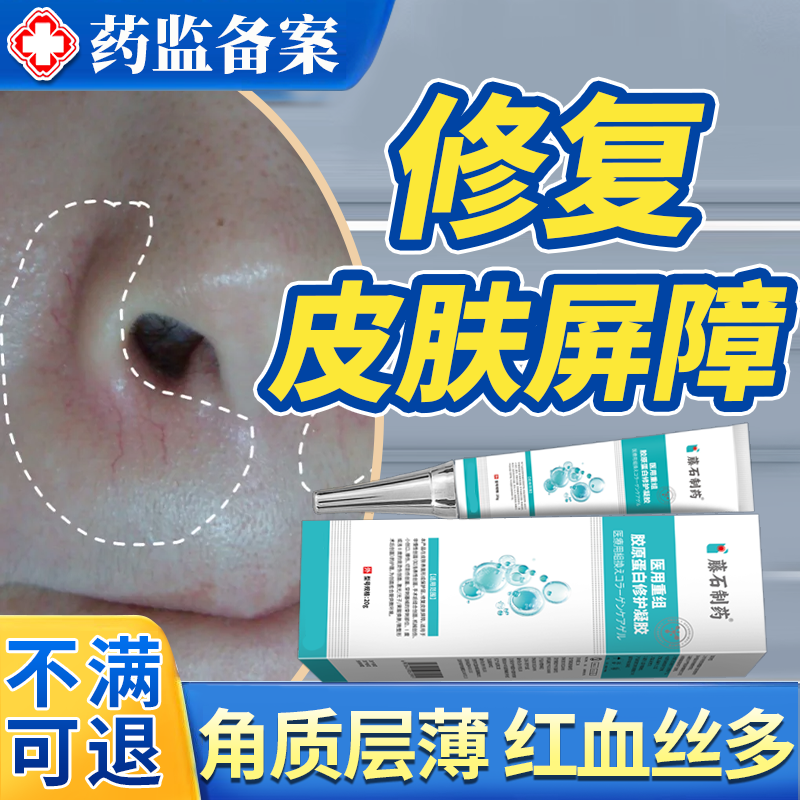 红血丝修去除角质层复祛鼻子两侧发红脱皮鼻翼两边泛红干燥起皮JW