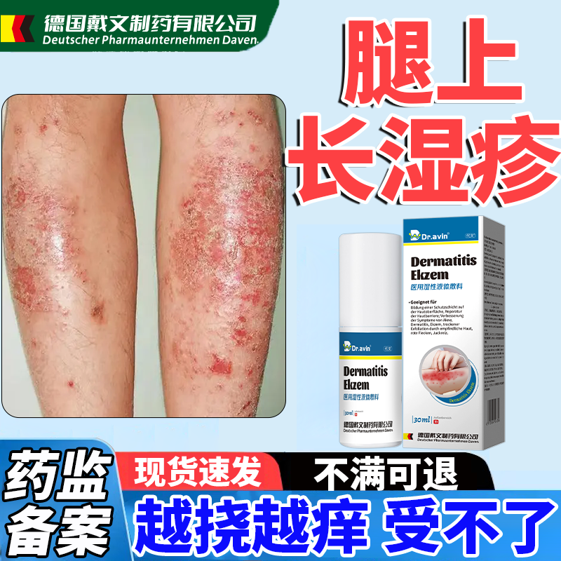 【医用级】湿疹专用止痒喷剂