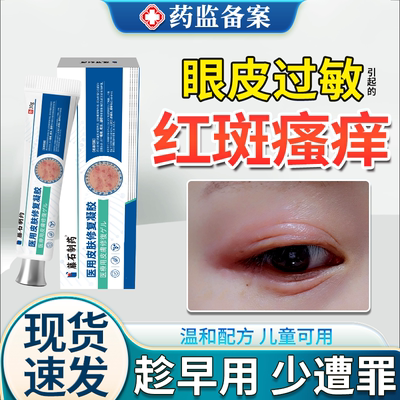 【现货速发】针对眼皮过敏红肿痒