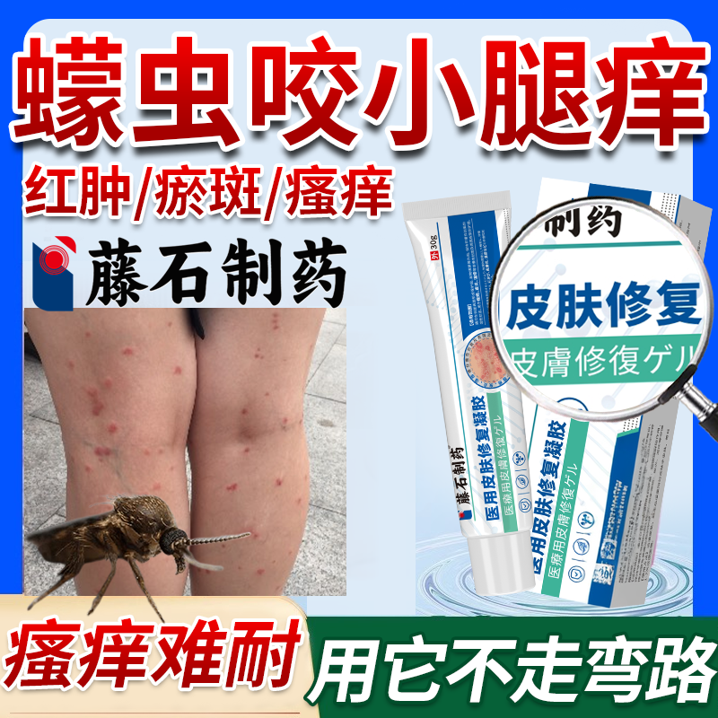 蠓虫槟榔虫叮咬毒虫海边可搭预防小咬喷雾蚊叮虫咬止痒消肿药膏OZ