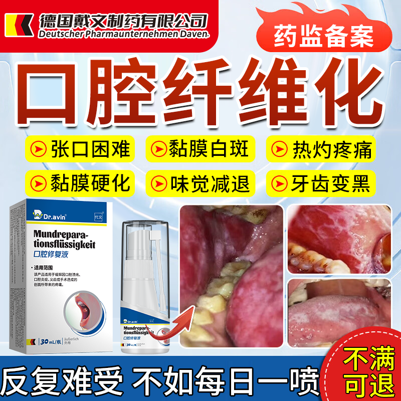 嚼槟榔口腔黏膜纤维化修复液漱口水白斑戒槟榔神器医用多肽牙膏EM,医疗器械,保健理疗,淘宝优惠券,粉丝福利购,淘宝优惠卷