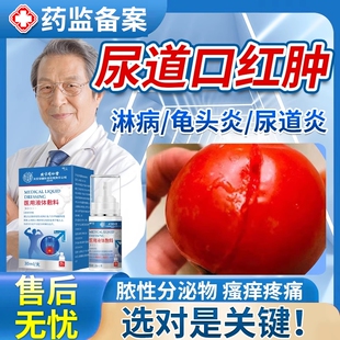 男性尿道口红肿瘙痒流脓尿道炎尿路感染专治用淋病特药监备案效EM
