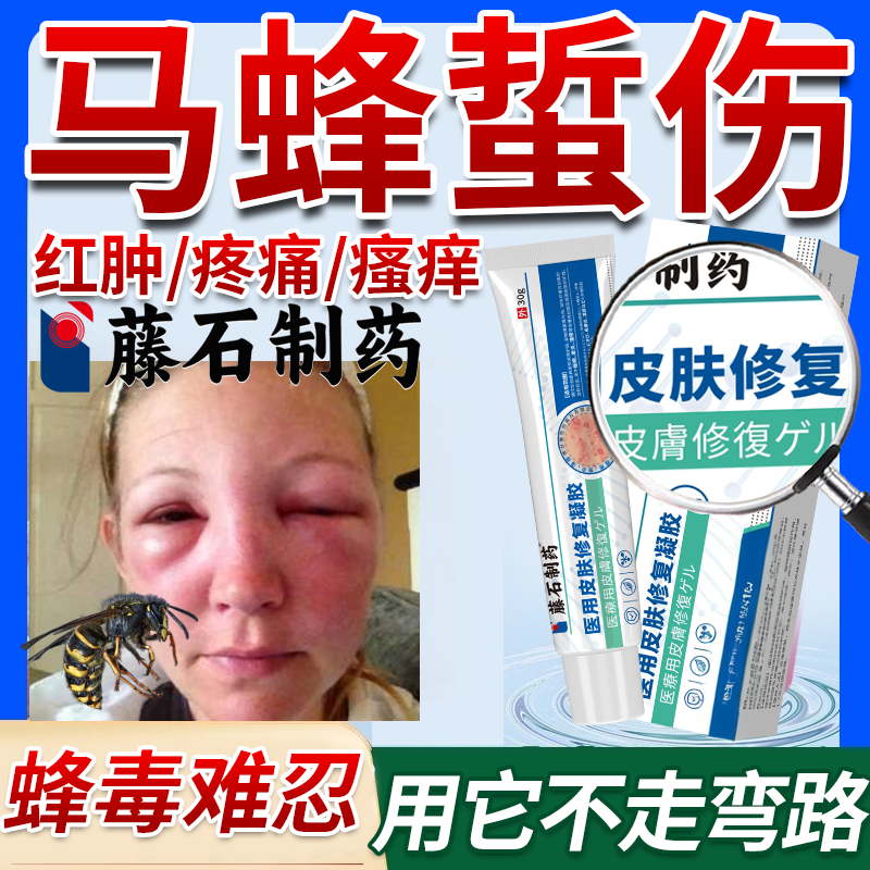 马蜂蛰伤药房同款膏蜜蜂叮咬黄蜂止痒消肿拔毒一喷养蜂人灵专用OZ