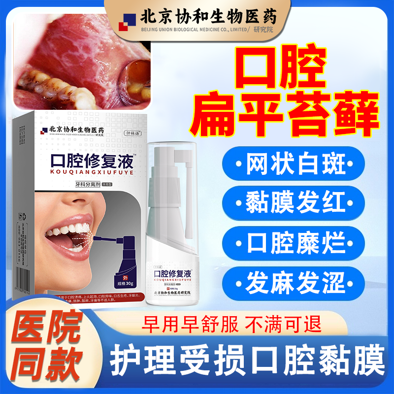 【口腔扁平苔藓】医用口腔修复液