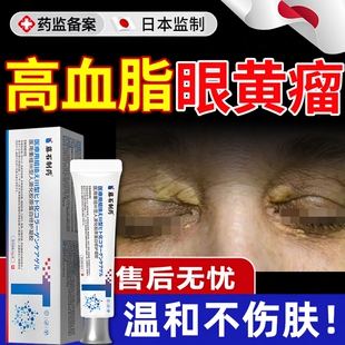 血脂高引起眼睑黄瘤疣去除神器去眼部皮黄斑瘤专用汗管瘤薬房膏EM