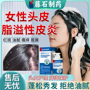 头皮屑脂溢性皮炎喷雾剂真菌感染毛囊炎头癣去屑止痒抑菌洗发水BS