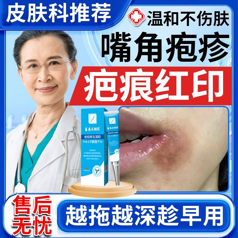 嘴角嘴唇疱疹遮黑印上火起水泡后留红印祛疤痕膏黑色素沉淀去除BS